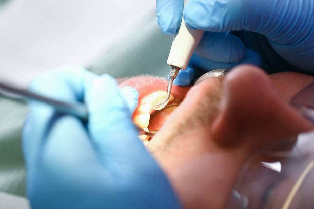 Best Broken or Cracked Tooth Emergency Dentist in Tifton, GA