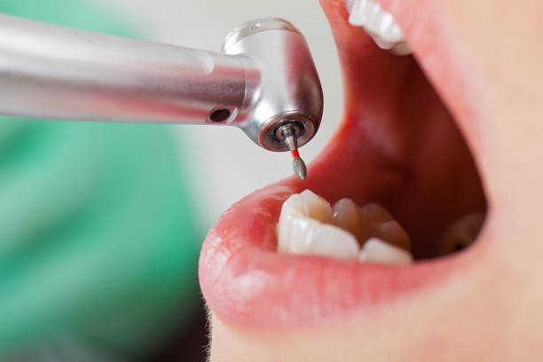 Best Emergency Dental Services for Seniors in Tifton, GA